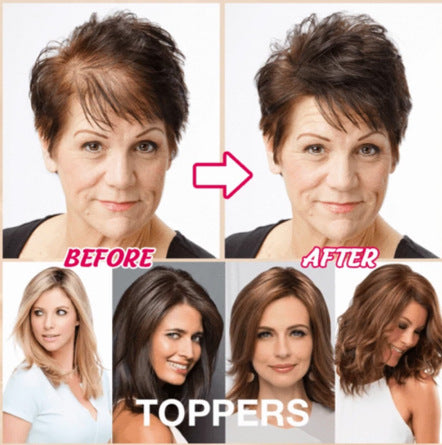 Human scalp cover - top cover white hair